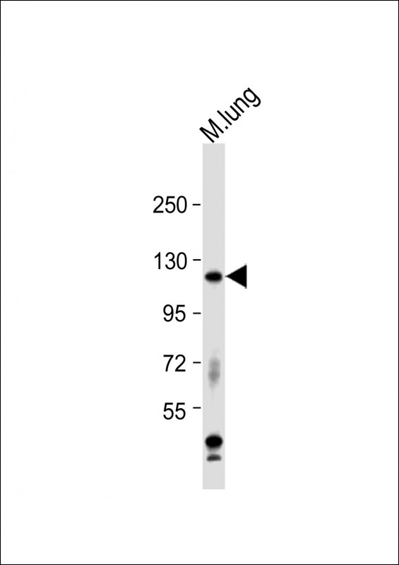 Rabbit Polyclonal Antibody to Mouse Epha2
