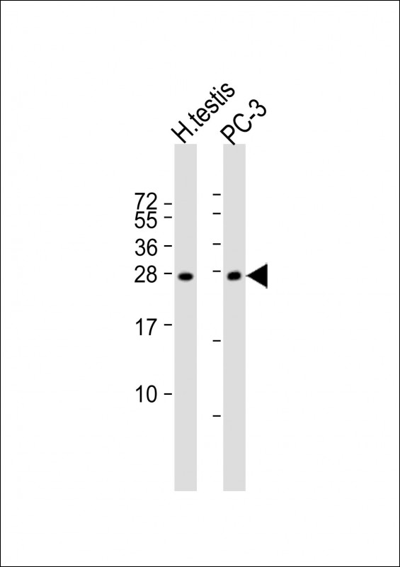 Rabbit Polyclonal Antibody to IL25
