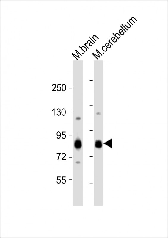 Rabbit Polyclonal Antibody to Mouse Prkcg (N-term)