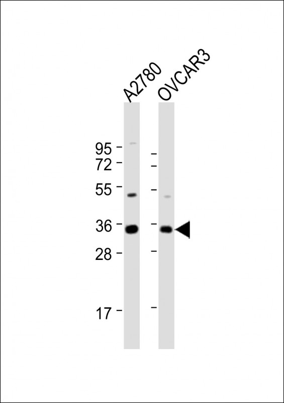 Rabbit Polyclonal Antibody to NANOG (N-term)