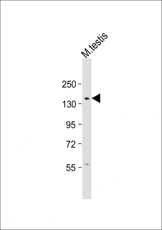 Rabbit Polyclonal Antibody to Mouse Cdk13 (N-term)