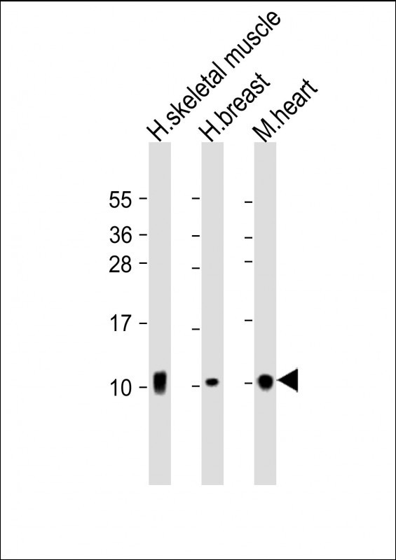Rabbit Polyclonal Antibody to COX7A1