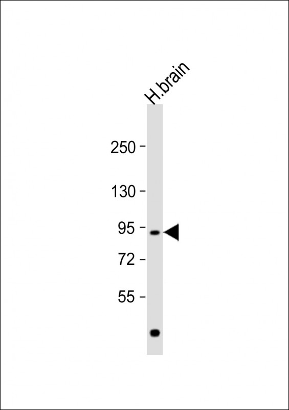 Rabbit Polyclonal Antibody to NLGN4Y (N-term)