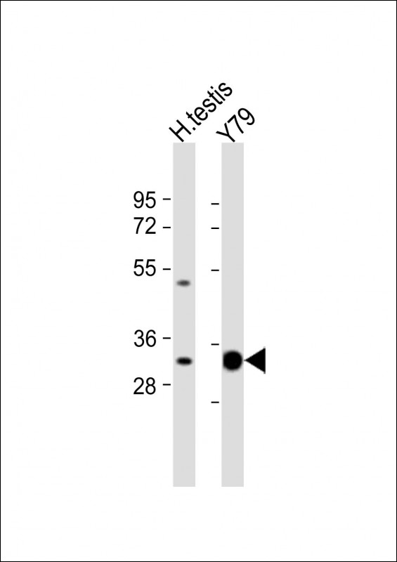 Rabbit Polyclonal Antibody to ELOVL4
