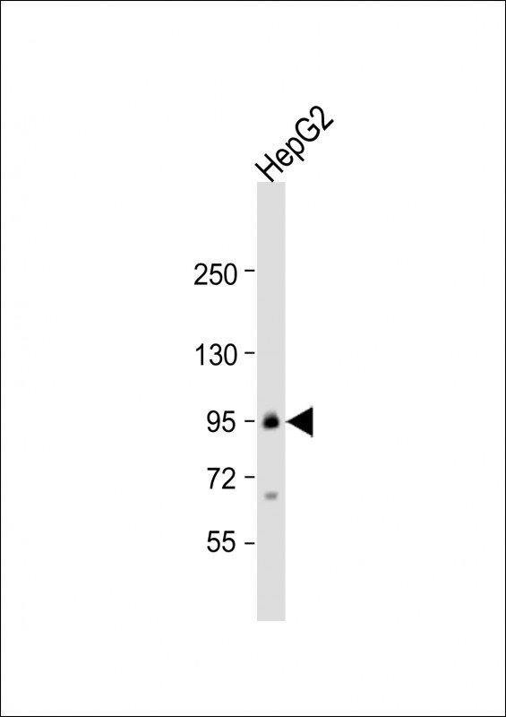 Rabbit Polyclonal Antibody to TRPC1