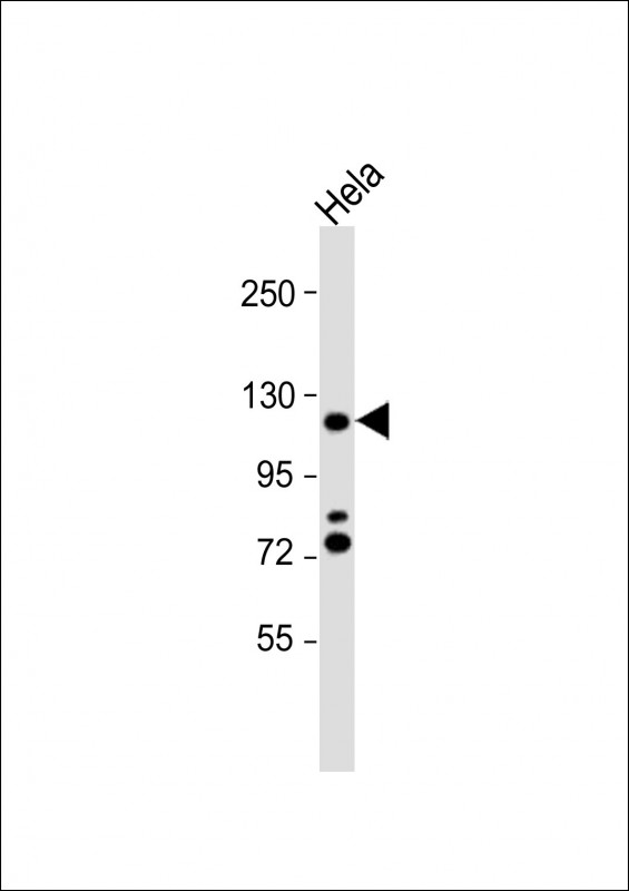 Rabbit Polyclonal Antibody to HIRA (N-term)