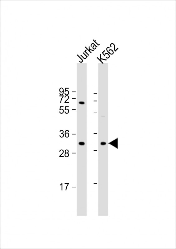 Rabbit Polyclonal Antibody to TP53RK