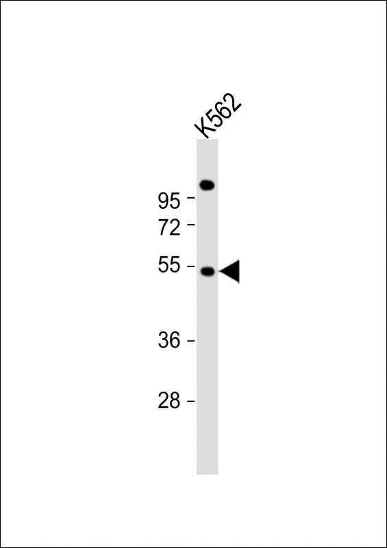 Rabbit Polyclonal Antibody to EIF2B3