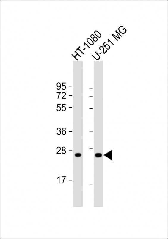 Rabbit Polyclonal Antibody to ULBP2