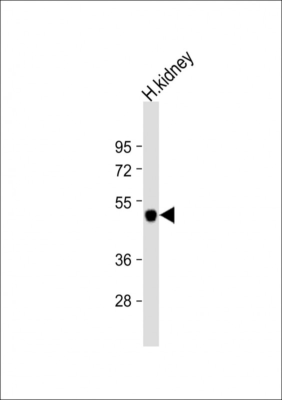 Rabbit Polyclonal Antibody to KCNJ15