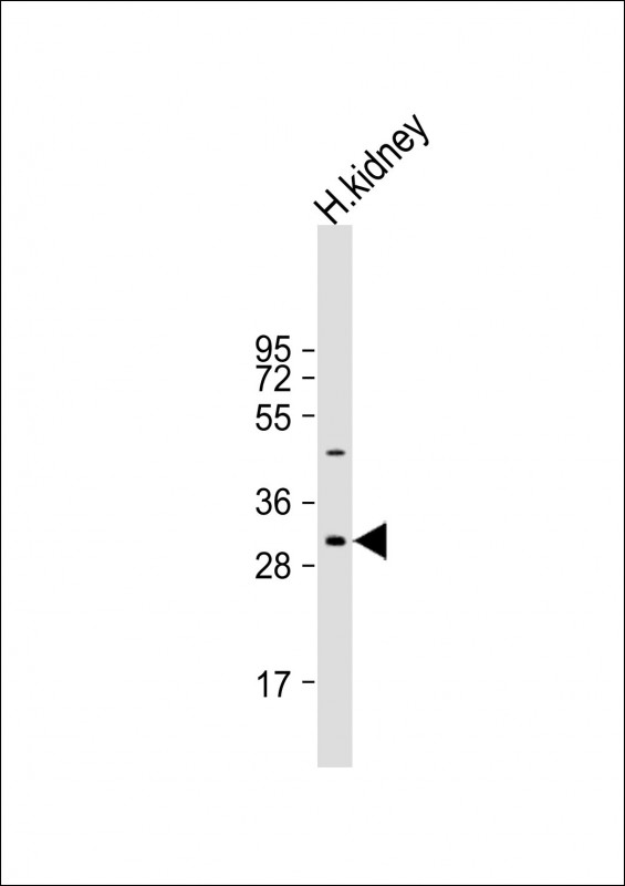 Rabbit Polyclonal Antibody to NRIP2