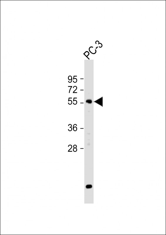 Rabbit Polyclonal Antibody to GPNMB