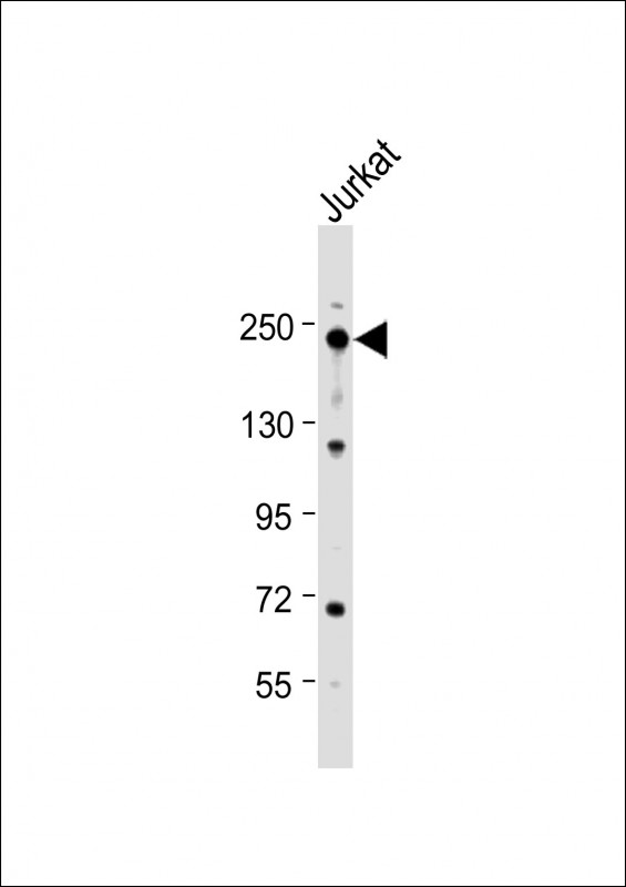 Rabbit Polyclonal Antibody to ERCC5