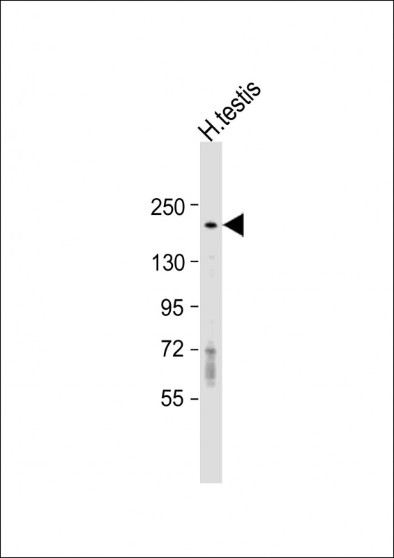 Rabbit Polyclonal Antibody to DLEC1