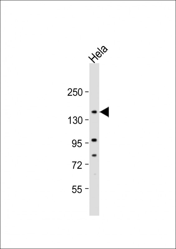 Rabbit Polyclonal Antibody to RIP140