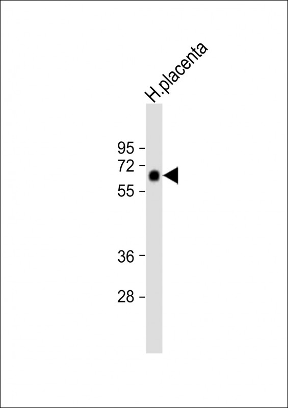 Rabbit Polyclonal Antibody to ZFP57