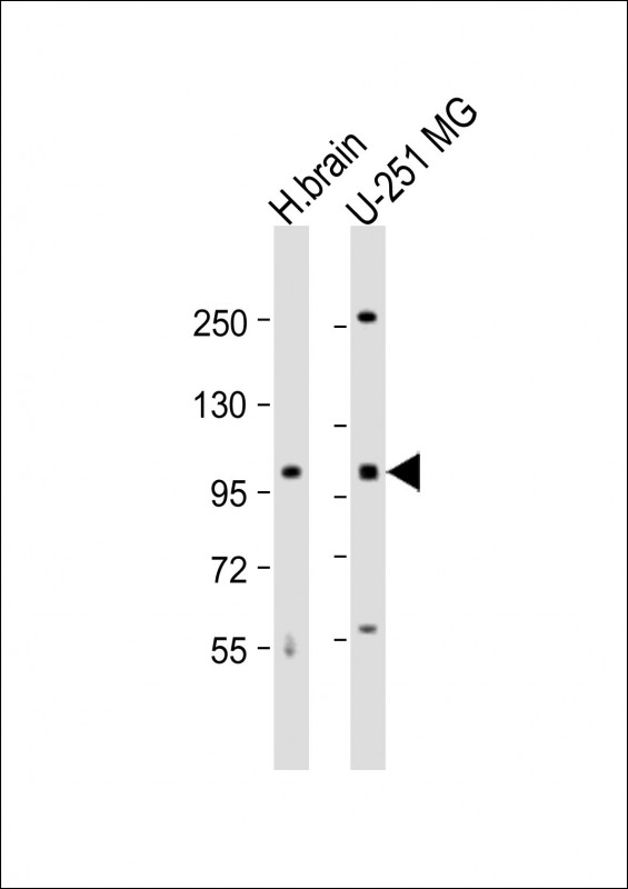 Rabbit Polyclonal Antibody to MBD6