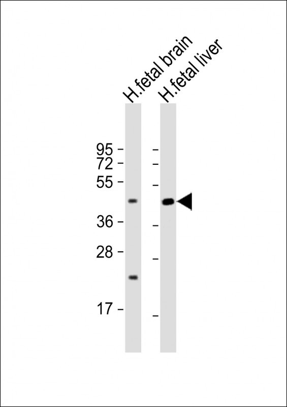 Rabbit Polyclonal Antibody to SLC30A10