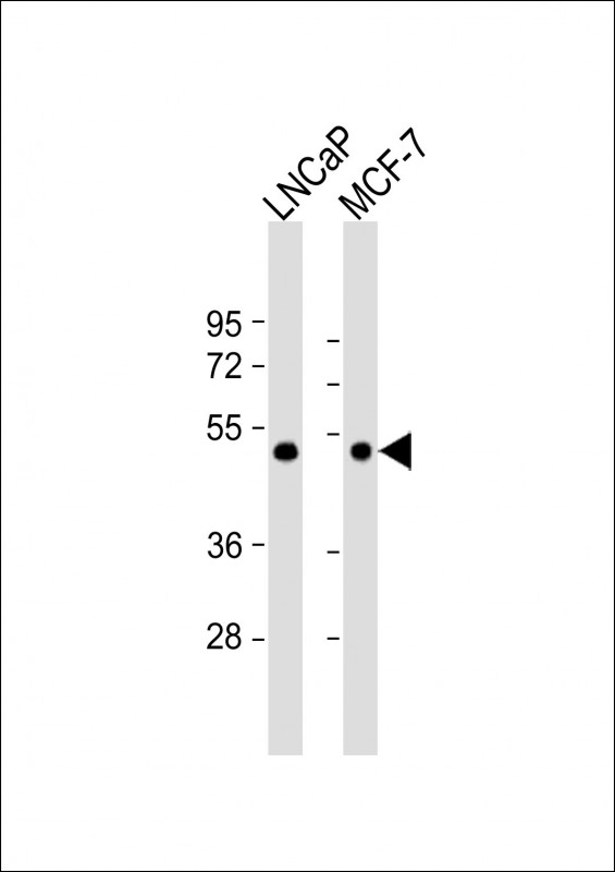 Rabbit Polyclonal Antibody to TXNIP(N-term)