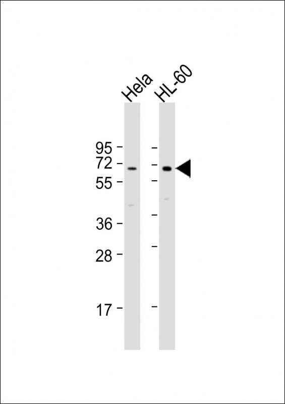 Rabbit Polyclonal Antibody to PIGB (N-term)