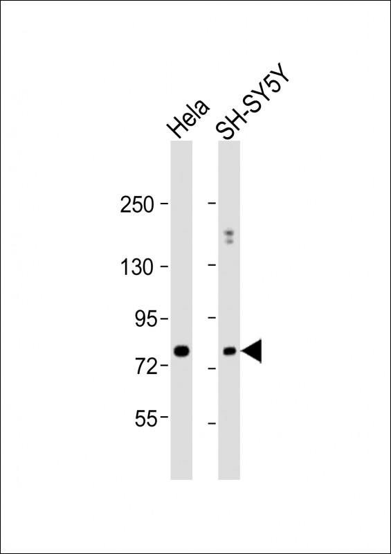 Rabbit Polyclonal Antibody to NSF