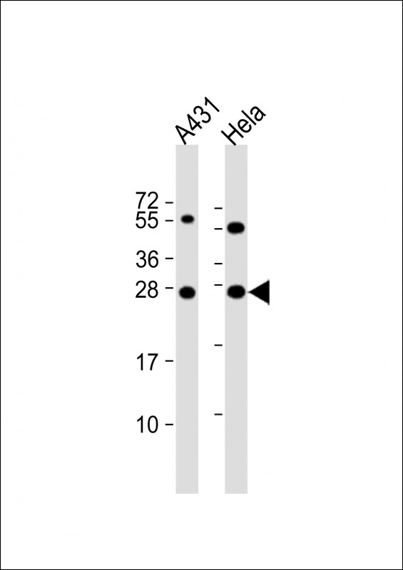 Rabbit Polyclonal Antibody to PSPH (N-term)