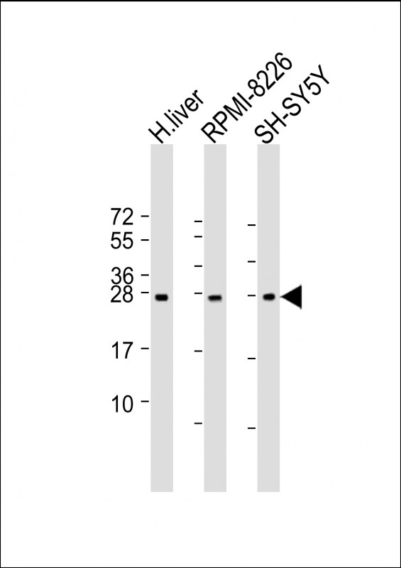 Rabbit Polyclonal Antibody to NT5M