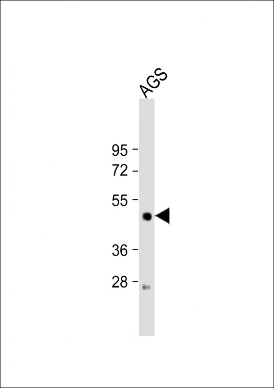 Rabbit Polyclonal Antibody to LIPF