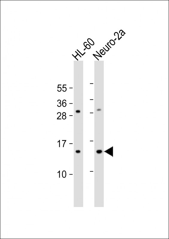 Rabbit Polyclonal Antibody to EIF1 (N-Term)