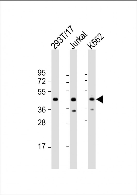 Rabbit Polyclonal Antibody to PHF6