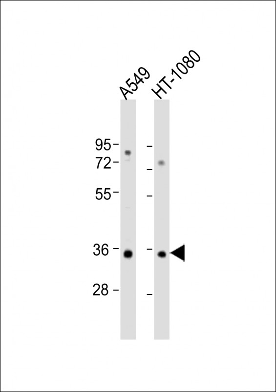 Rabbit Polyclonal Antibody to RSPO3