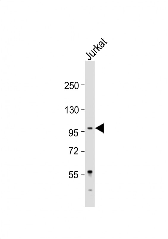 Rabbit Polyclonal Antibody to LARGE