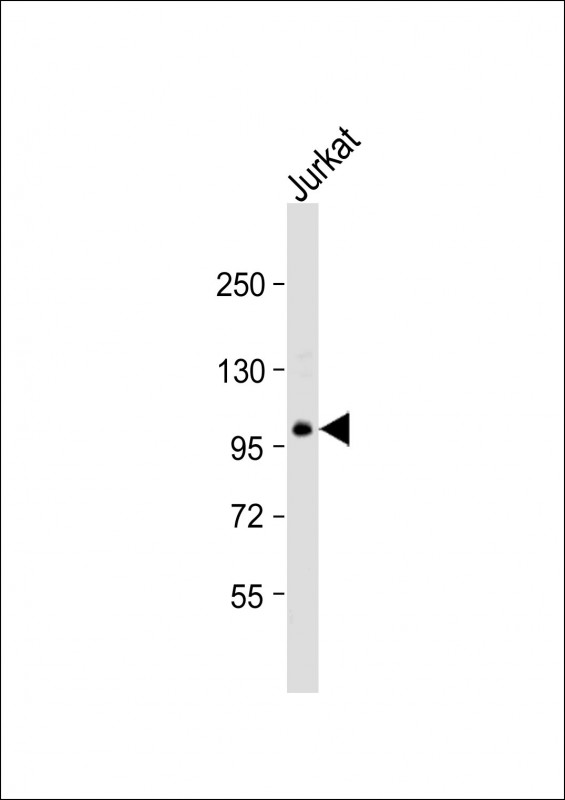 Rabbit Polyclonal Antibody to TSC22D1