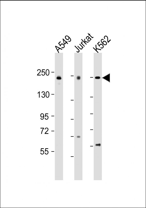 Rabbit Polyclonal Antibody to PSME4 (N-Term)