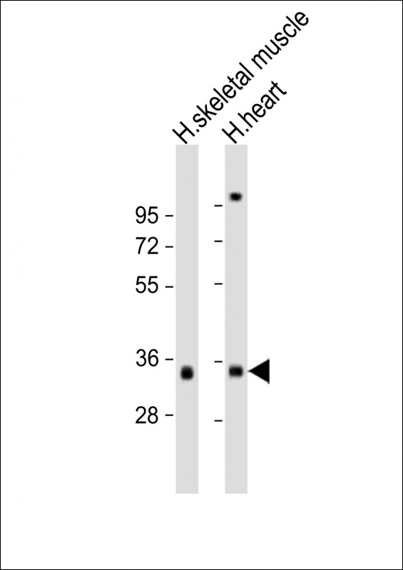 Rabbit Polyclonal Antibody to TPM3