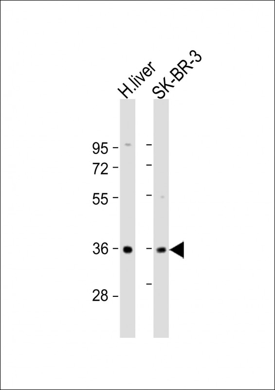 Rabbit Polyclonal Antibody to AKR7A3