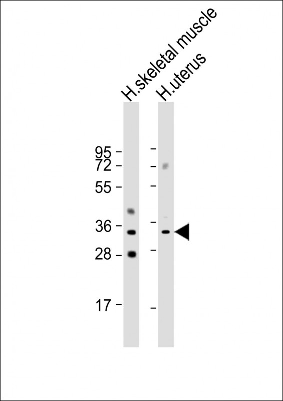 Rabbit Polyclonal Antibody to RSPO3