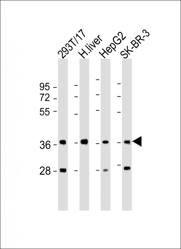 Rabbit Polyclonal Antibody to AKR7A3 (N-Term)