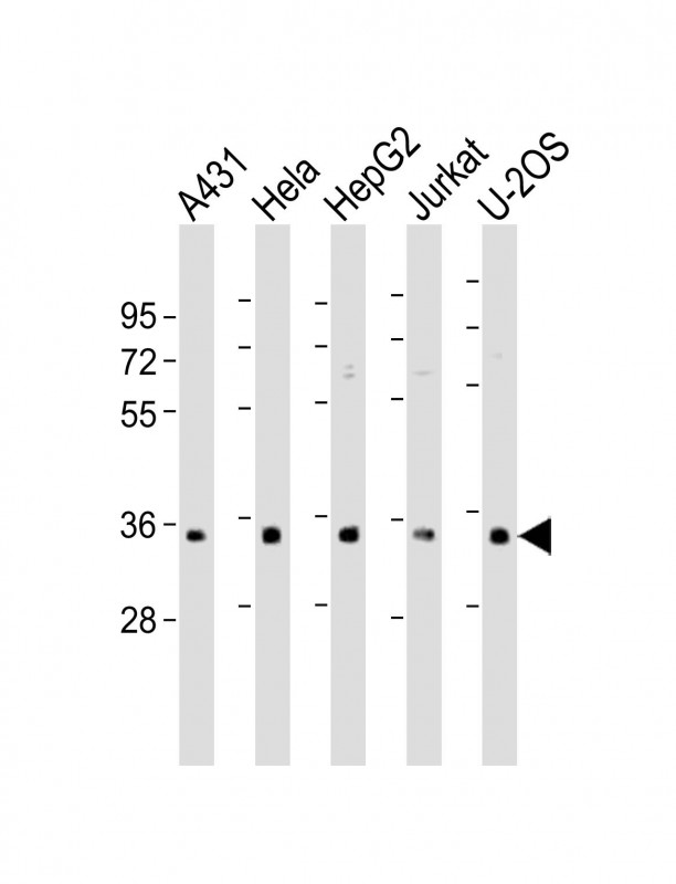 Rabbit Polyclonal Antibody to RNPS1 (N-Term)