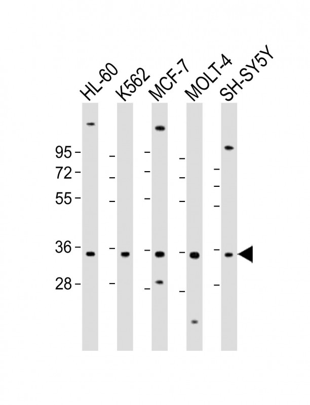 Rabbit Polyclonal Antibody to PIGC