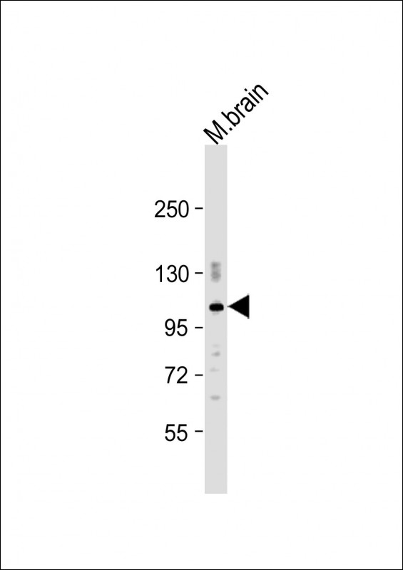 Rabbit Polyclonal Antibody to PDE2A