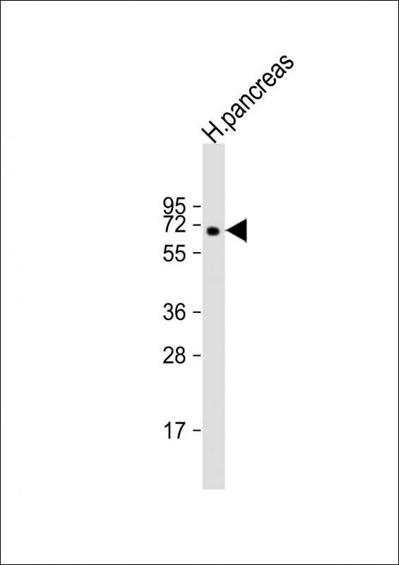 Rabbit Polyclonal Antibody to MGAT4B (N-Term)