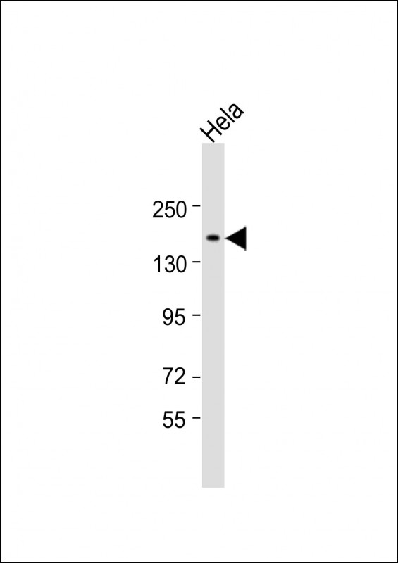 Rabbit Polyclonal Antibody to CHD5 (N-Term)