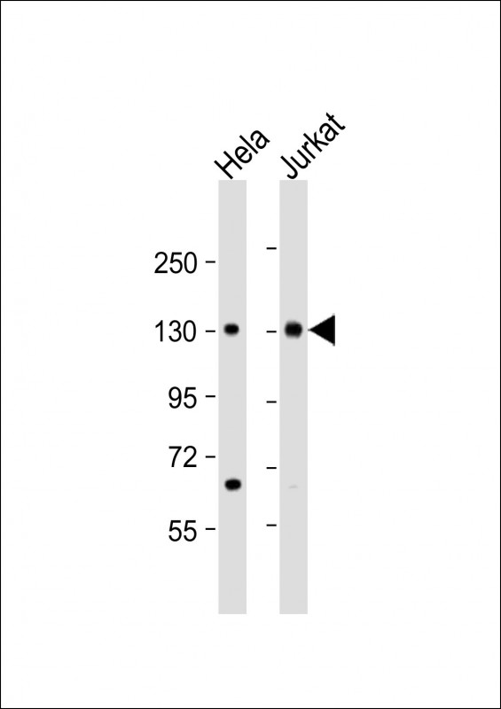 Rabbit Polyclonal Antibody to MTUS1
