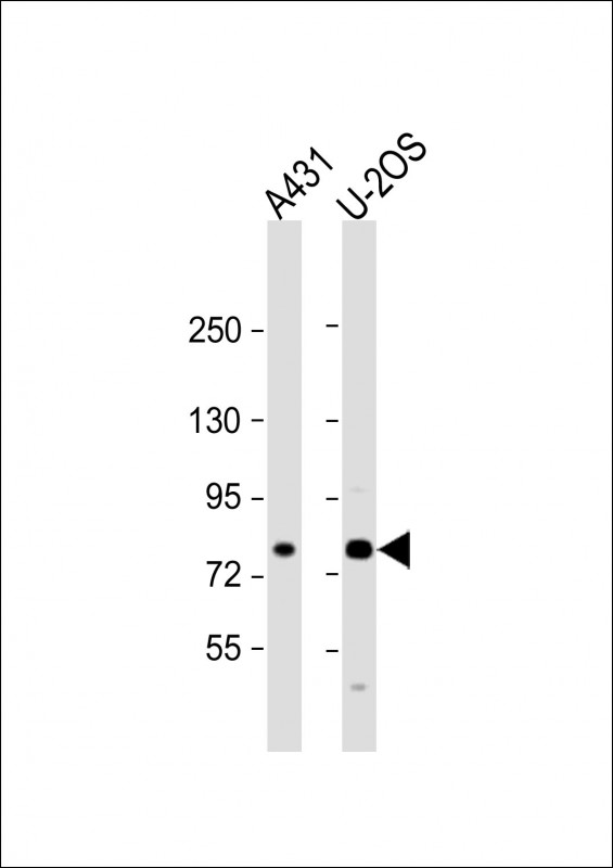 Rabbit Polyclonal Antibody to MAN1A2