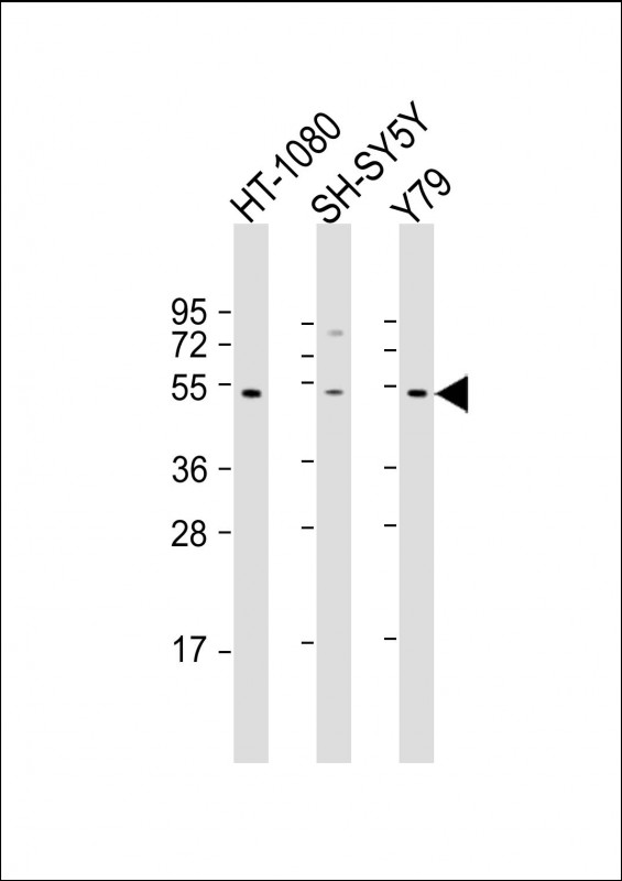 Rabbit Polyclonal Antibody to ZNF513 (N-Term)
