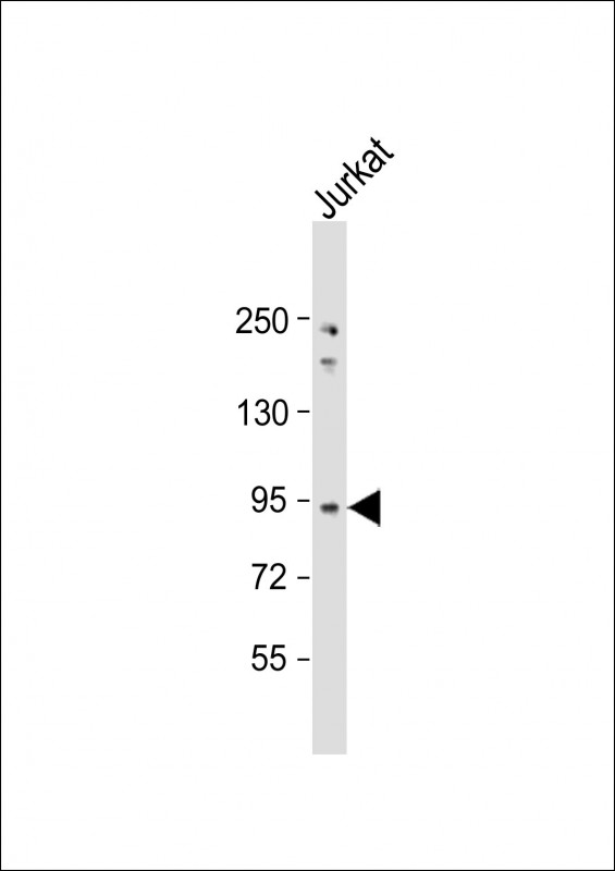 Rabbit Polyclonal Antibody to NUP93