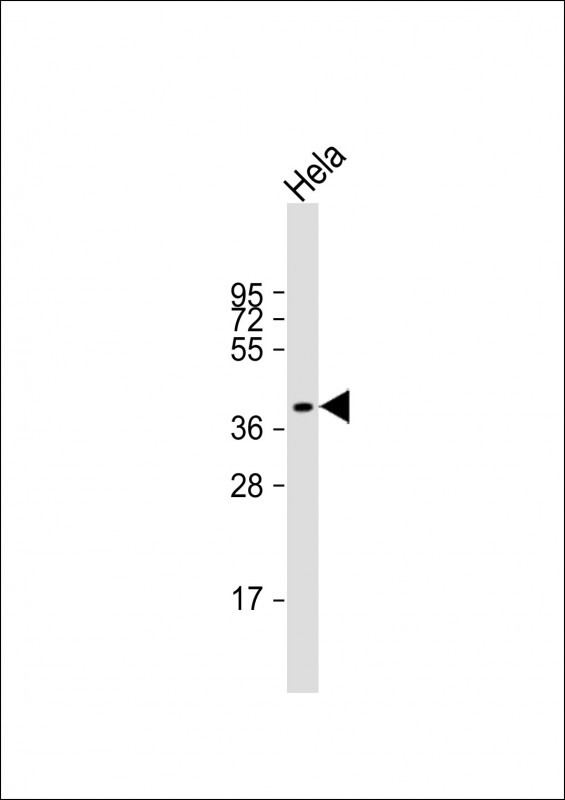 Rabbit Polyclonal Antibody to LPGAT1