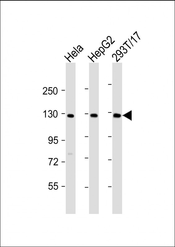 Rabbit Polyclonal Antibody to LRIG3 (N-Term)