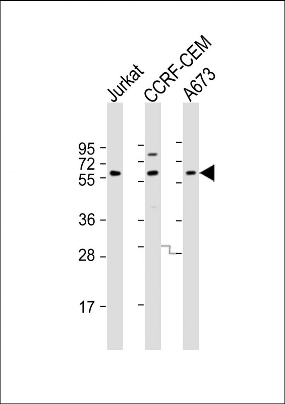 Rabbit Polyclonal Antibody to CCT8L2 (N-Term)